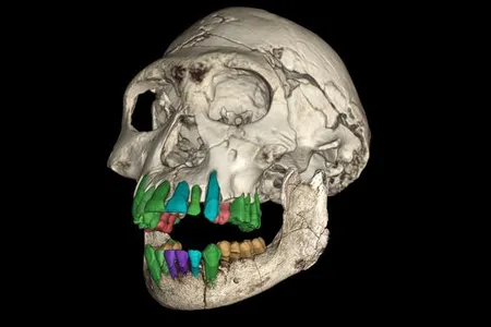 A 3D reconstruction of the fossil skull of a youth of an early&nbsp;Homo&nbsp;species from Dmanisi, Georgia. The green, orange and red colors represent the preserved teeth, while the blue represent missing ones and the purple teeth have not been recovered.