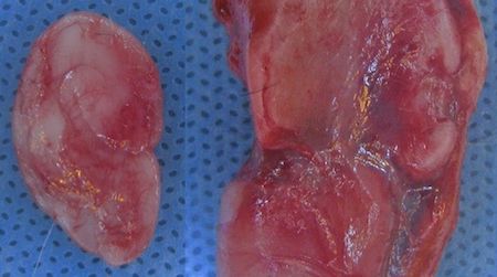 One of the Cornell team’s prosthetic ears, created from living cartilage cells.