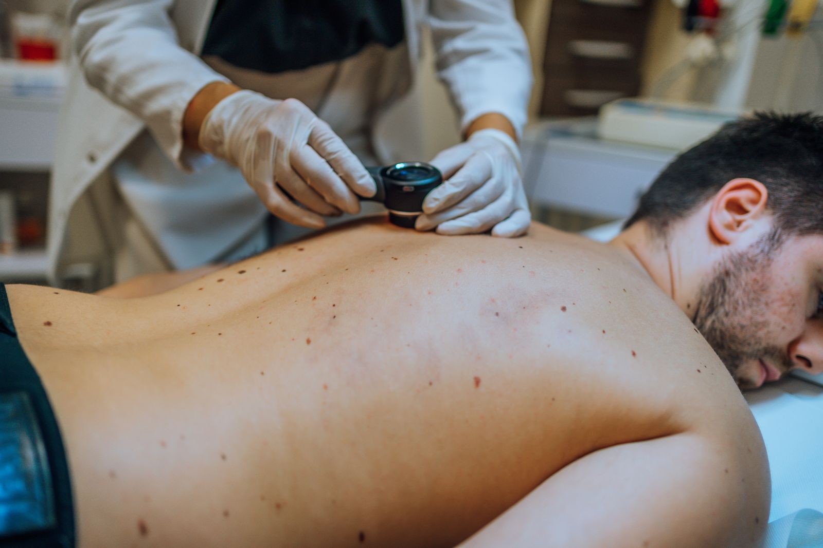 A New Personalized Cancer Vaccine Could Keep Skin Cancer From Coming Back, Drugmakers Say