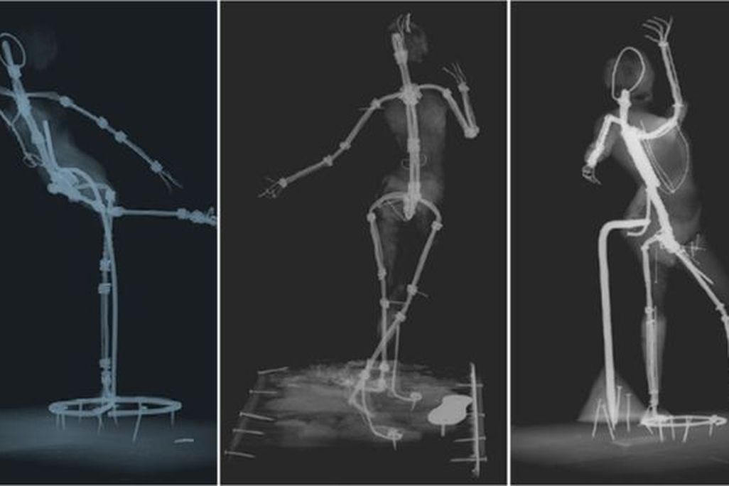 Degas X-rays
