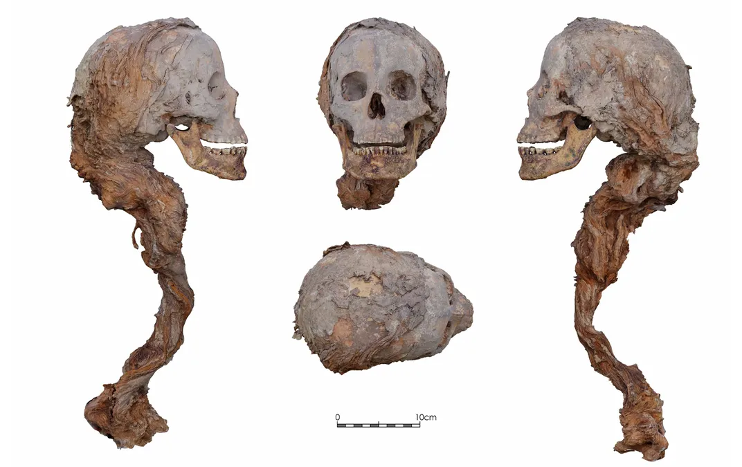 The skull of one of the women buried in Artau de Foces' grave
