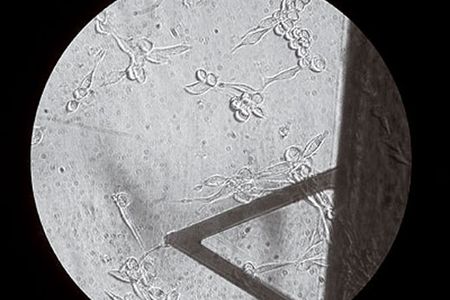 Gimzewski uses an atomic force microscope (above, atop a bone cell) to "listen" to living cells.