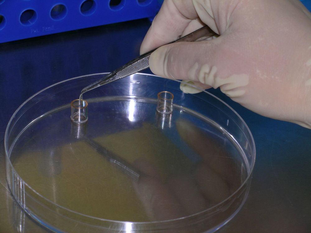 Cloning cell-line colonies using cloning rings