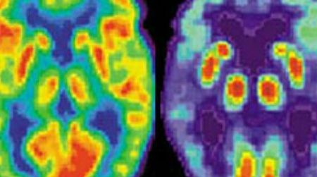 More clues than answers?