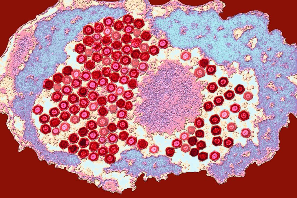 Herpes Virus
