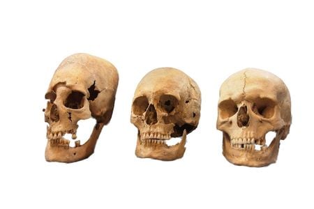 Strong, medium and undeformed skulls, from left to right in this image, were first found in Germany around the 1960s. Now researchers think they know where the modified skulls came from.