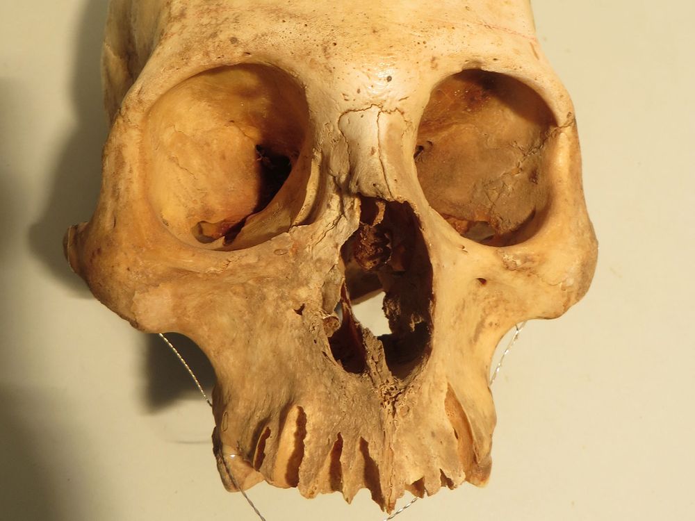 Chilean Skull