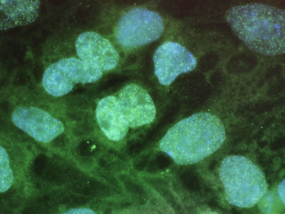 Stem cells as seen on a computer screen
