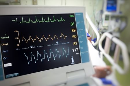 While the peaks and valleys on people's ECGs may look identical to the untrained eye, they’re actually anything but.