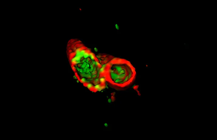 Before killing Salmonella, the detergent-like protein APOL3 (green) must get through the bacteria's protective outer membrane (red).