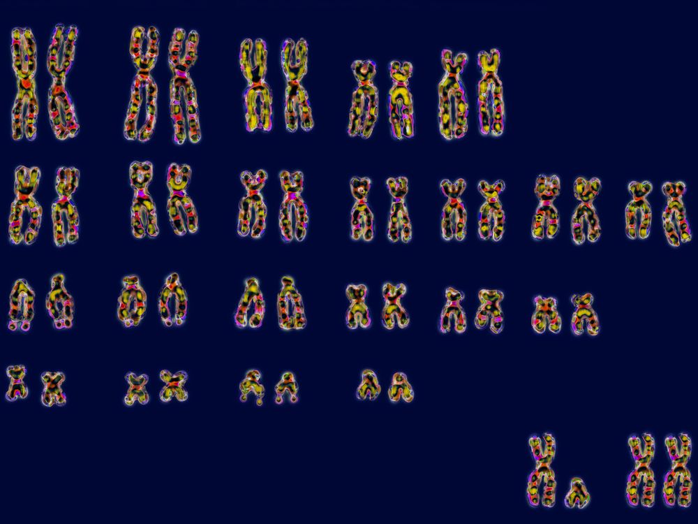 An image of the 23 pairs of human chromosomes, with both the XX and XY sex chromosomes