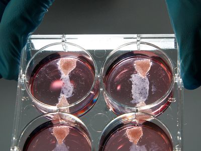 Samples of cultured meat grown in a laboratory are seen at the University of Maastricht on November 9, 2011. Scientists are cooking up new ways of sustainably feeding the world's hunger for resource-intensive foods like meat products.