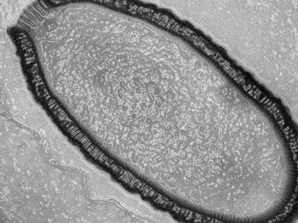 The World’s Largest Virus Was Just Resurrected From 34,000-Year-Old Permafrost