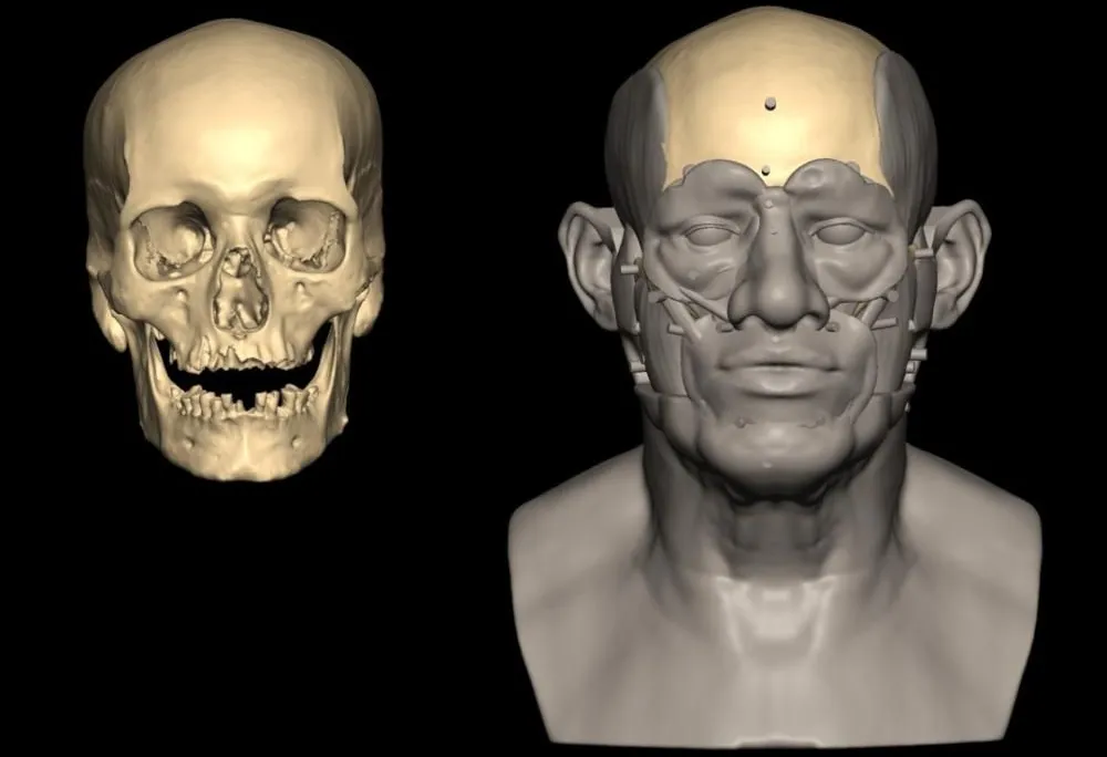 Facial reconstruction
