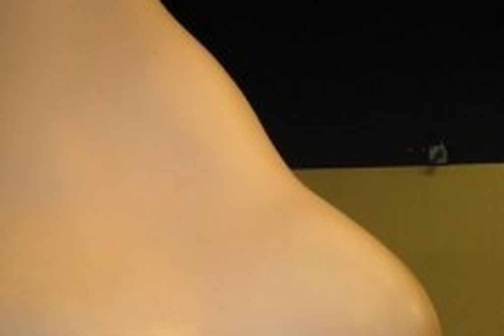 20110520102359nose-225x300.jpg