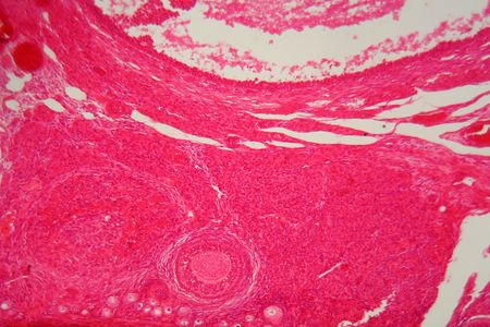 Ovarian cells did their thing in a dish for researchers who used microfluidics and chips to recreate a female menstrual cycle. 