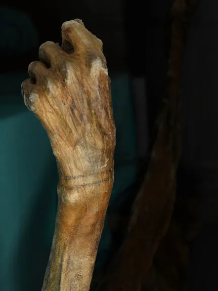 Bracelet-like tattoo of the 5,300-year-old Iceman