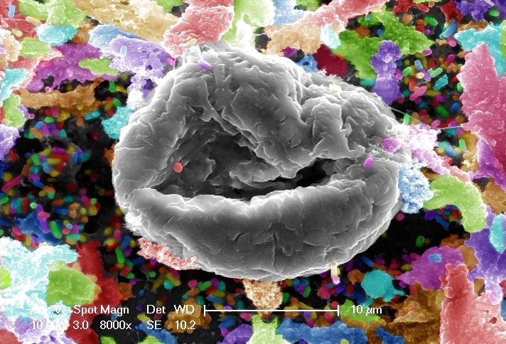 Jaws in a Candyland : High magnification of the exterior of a Colpoda ...