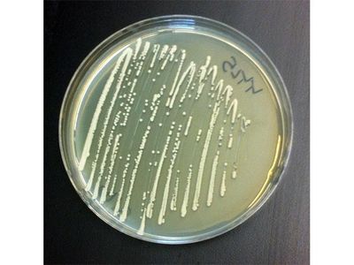 Yeast, a multipurpose microbe.