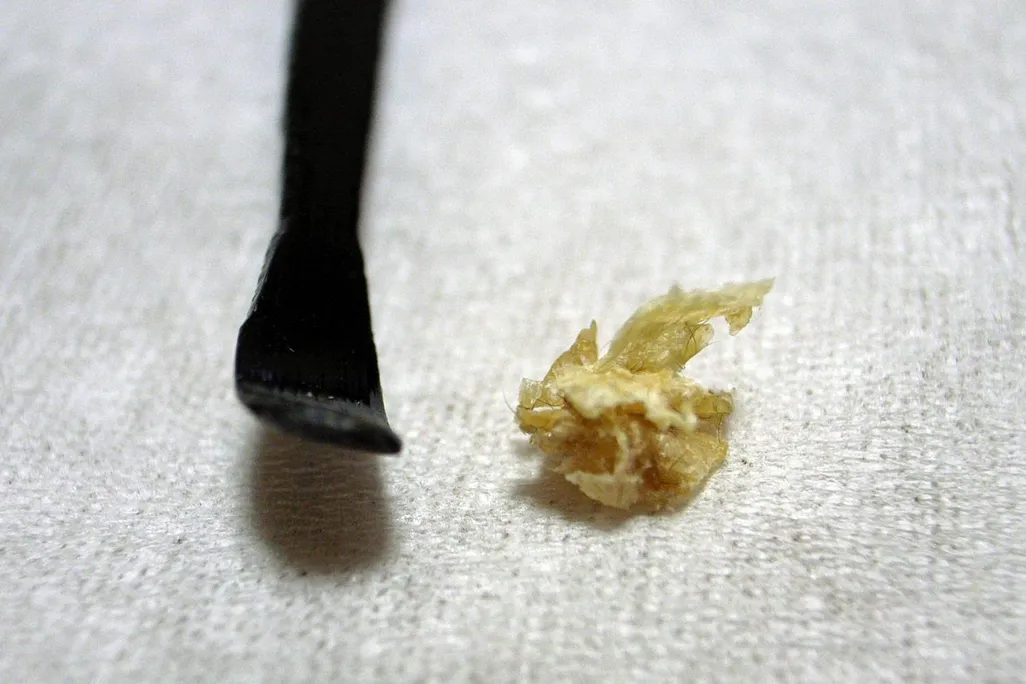 03_20_2014_earwax.jpg