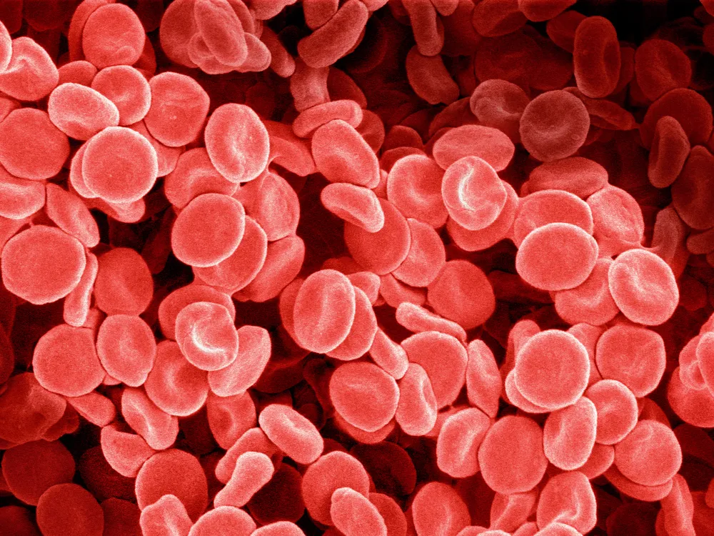 Human red blood cells at 1,000 times magnification.
