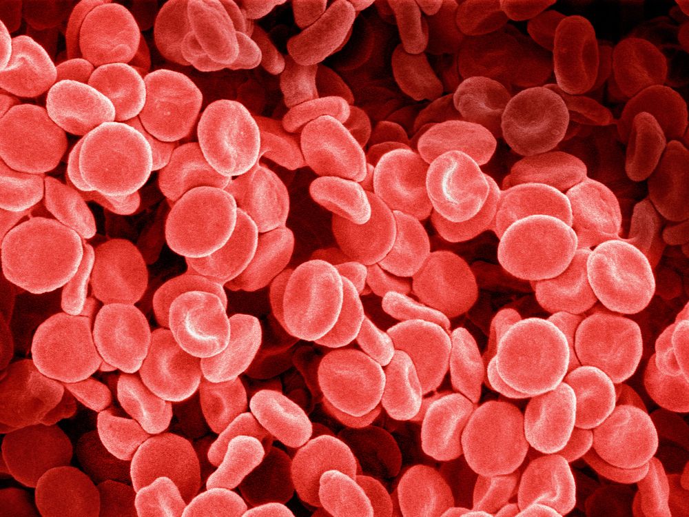 Forms Of Red Blood Cells At Edna Weiss Blog