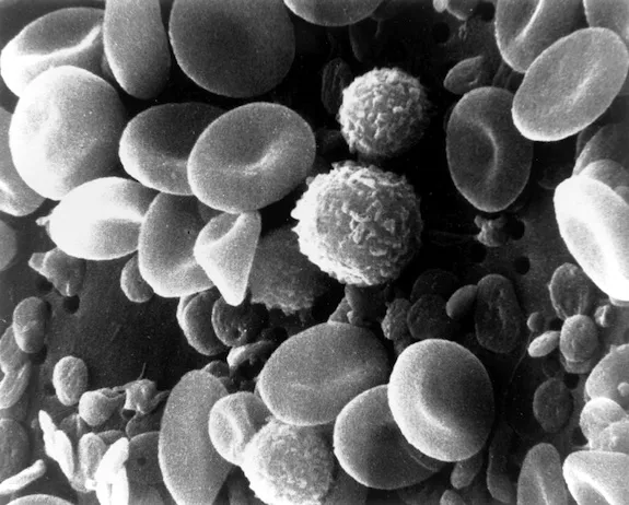 20131024101027SEM_blood_cells.jpg