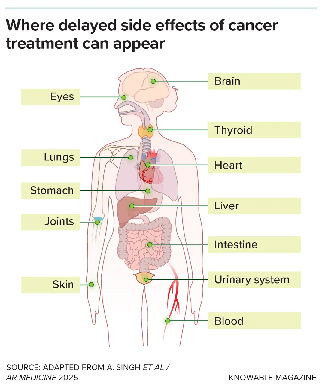 un gráfico do corpo humano mostra os efectos secundarios atrasados ​​do tratamento do cancro poden aparecer no cerebro, ollos, tireóide, pulmóns, corazón, estómago, fígado, articulacións, intestino, pel, sistema urinario e sangue