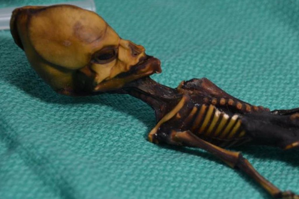 Ata_Chilean skeleton.jpg