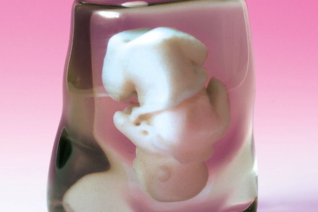 Clear rosin represents the mother’s tissue, while the fetus is suspended in white.