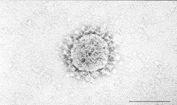 Six weeks after authorities said SARS had broken out in Asia, CDC scientists in Atlanta identified a coronavirus as the culprit.