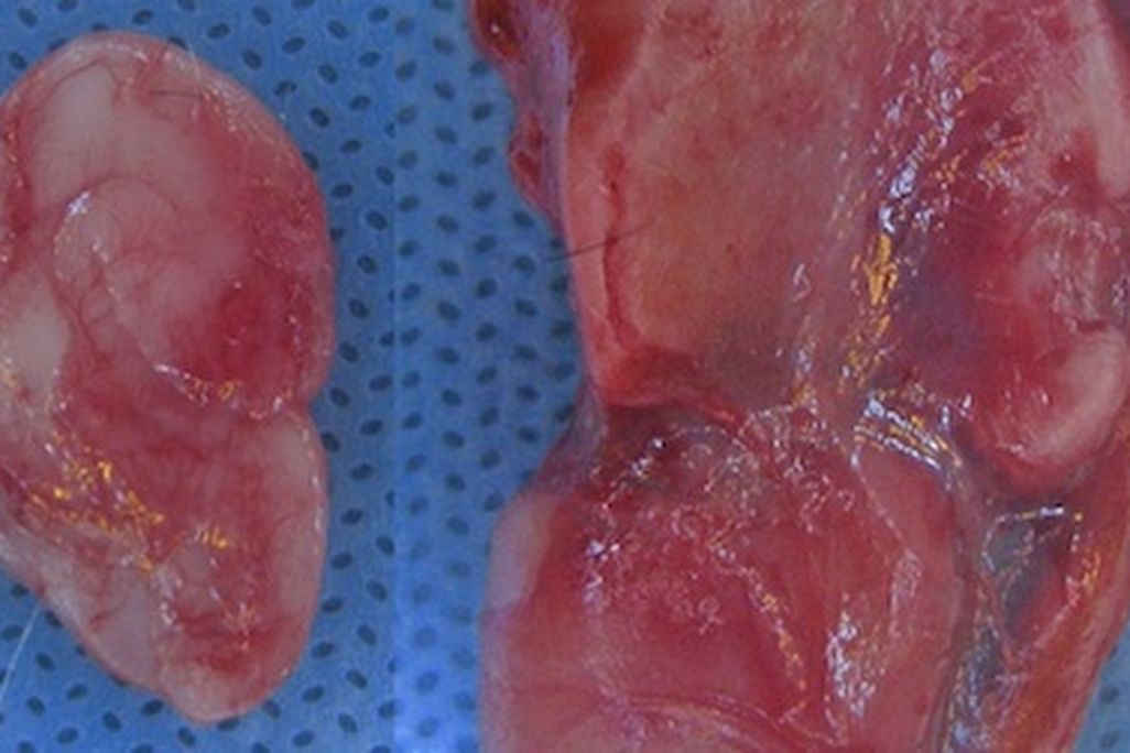 One of the Cornell team’s prosthetic ears, created from living cartilage cells.
