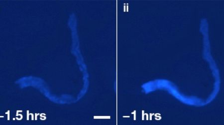Blue fluorescence spreads through a dying nematode worm, revealing the passage of death through its body over the hour and a half prior to the organism’s complete expiration.
