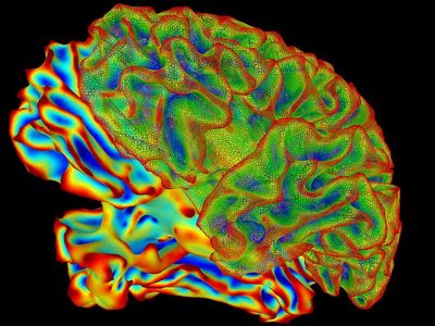 fMRI changed the way researchers look at the human brain.