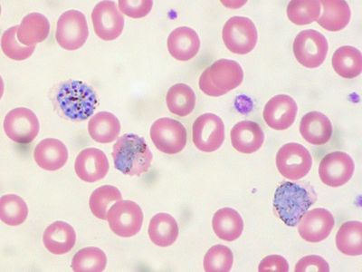 Malaria infected blood cells (blue)