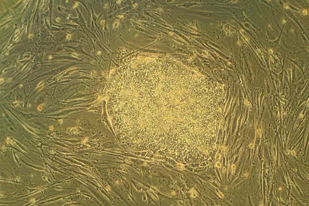 Human embryonic stem cells in cell culture