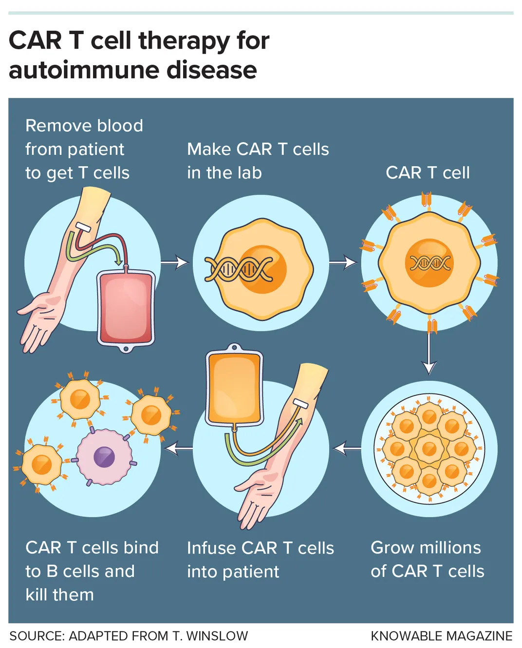 How a Revolutionary Cancer Treatment Could Reset the Immune Systems of Patients With Autoimmune Diseases