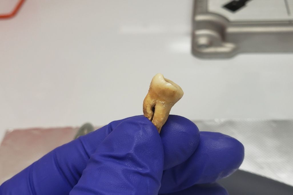 tooth