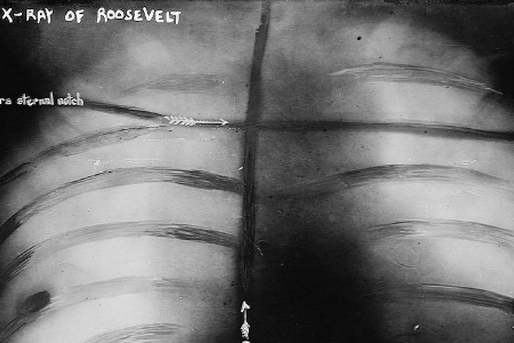 Roosevel_xray.jpg