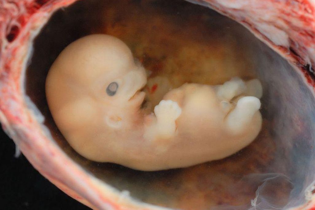 Human Embryo