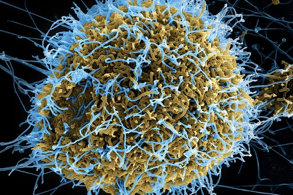 ebola