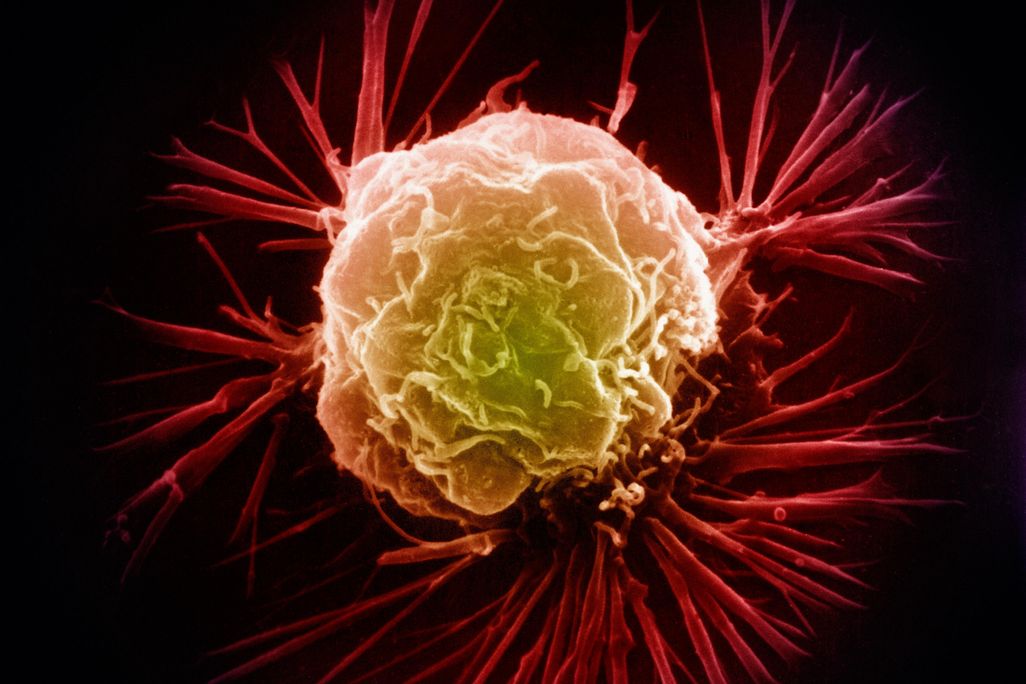 Breast Cancer Cell