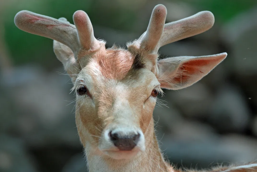 humans born with horns