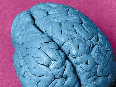 Leborgne’s brain (colorized photo) has appeared in numerous medical textbooks.