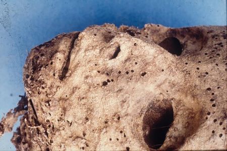The mummified remains of a small child that bears evidence of an ancient Hepatitis B infection.