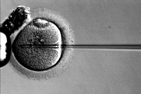 Intracytoplasmic sperm injection (ICSI) is a more modern form of IVF.