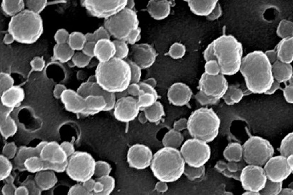 Bacteria reside amongst the icy brine from Lake Vida.