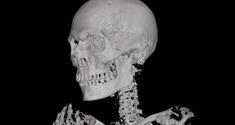 20110913092004ATM-mummy-CT-scan-470.jpg