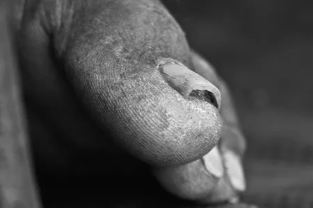 Your big toe is an example of how "boundary conditions" can affect the curvature of a nail.