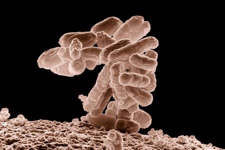 Sand grains or microbes?  In this case, it's a cluster of E. coli bacteria. But it can be hard to tell, so we'll need discerning new instruments. 